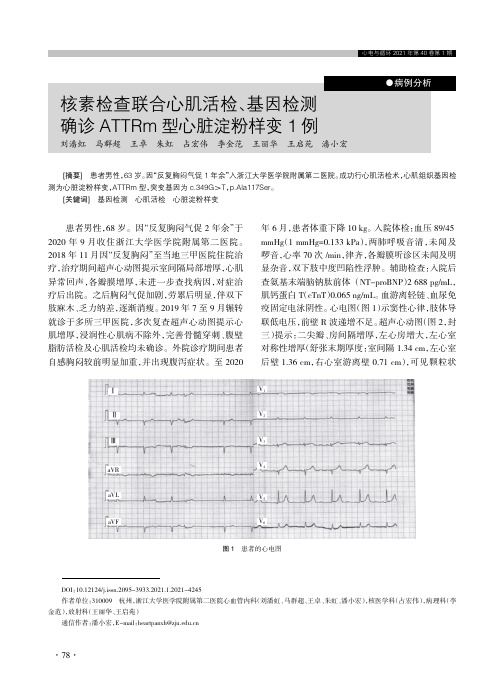 核素检查联合心肌活检、基因检测确诊ATTRm型心脏淀粉样变1例