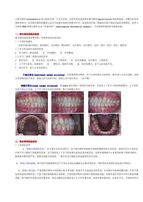 正畸