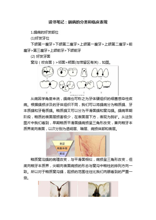 读书笔记：龋病的分类和临床表现