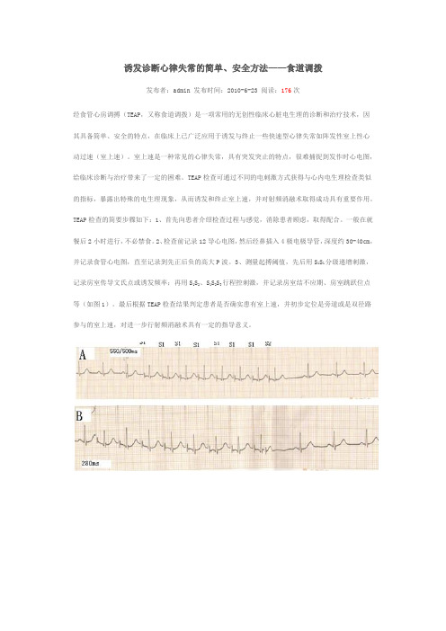 食道调拨