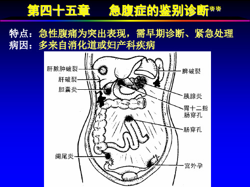 第四十五章急腹症的鉴别诊断