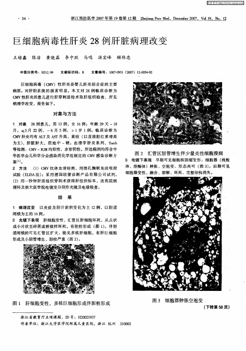 巨细胞病毒性肝炎28例肝脏病理改变