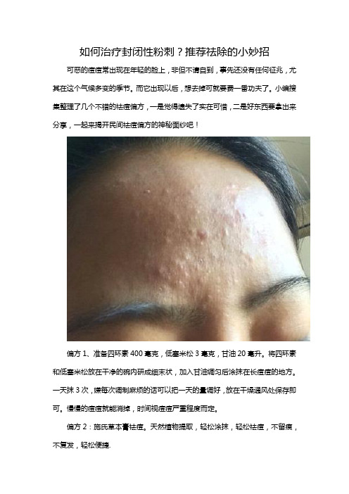 如何治疗封闭性粉刺？告诉你一个小妙招