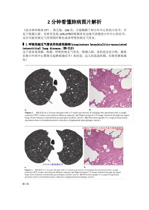 2分钟看懂肺病图片解析