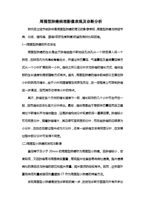 周围型肺癌病理影像表现及诊断分析