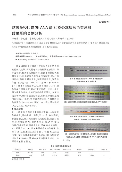 欧蒙免疫印迹法（ANA谱3）模条本底颜色变深对结果影响2例分析