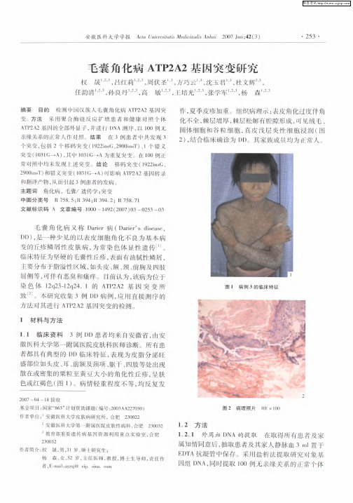 毛囊角化病ATP2A2基因突变研究