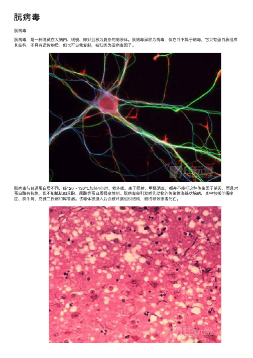 朊病毒——精选推荐