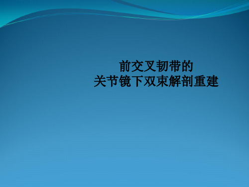 一文看懂前交叉韧带镜下双束解剖重建