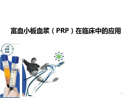 PRP的临床应用ppt课件