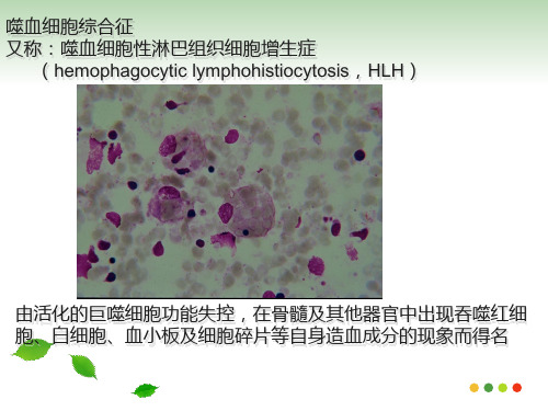 噬血细胞综合征HPS_PPT幻灯片