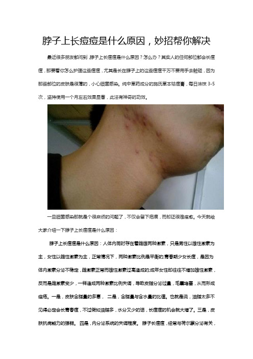 脖子上长痘痘是什么原因,妙招帮你解决