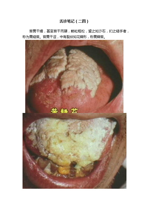 舌诊笔记（二四）