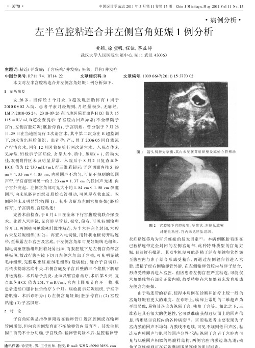 左半宫腔粘连合并左侧宫角妊娠1例分析