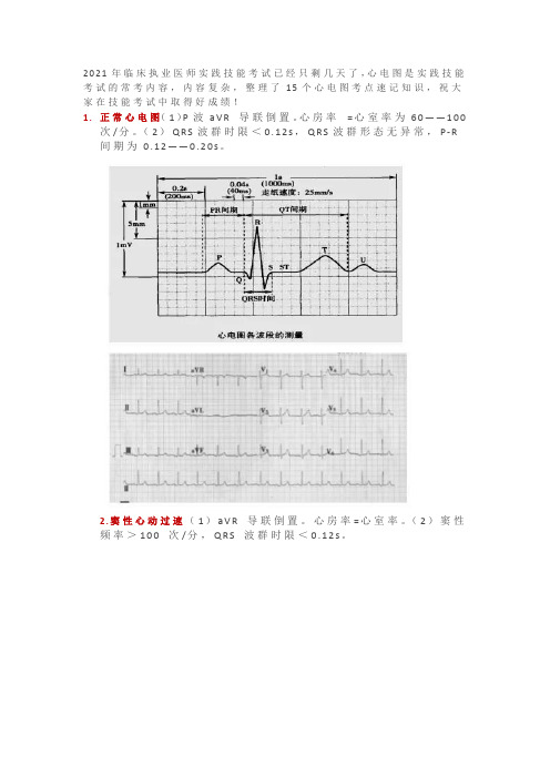 临床执业医师实践技能考试15种心电图速记