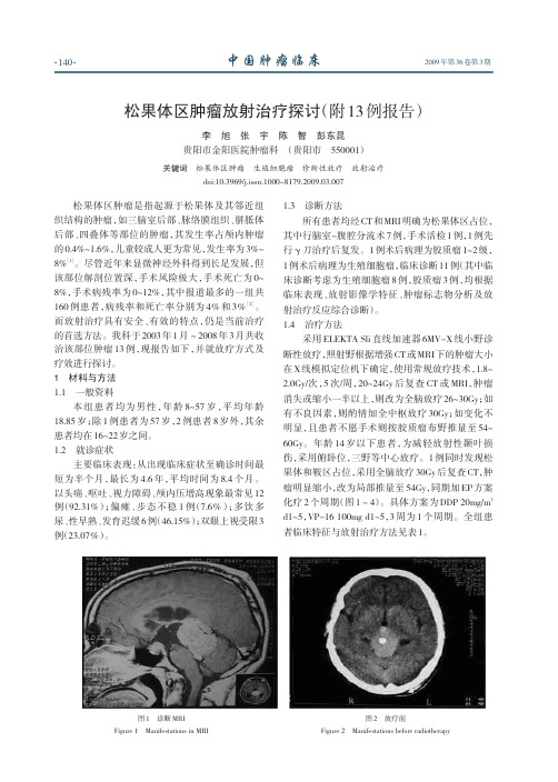 松果体区肿瘤放射治疗探讨(附13例报告)