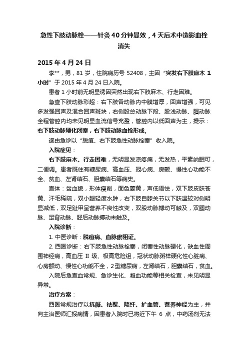 急性下肢动脉栓——针灸40分钟显效，4天后术中造影血栓消失