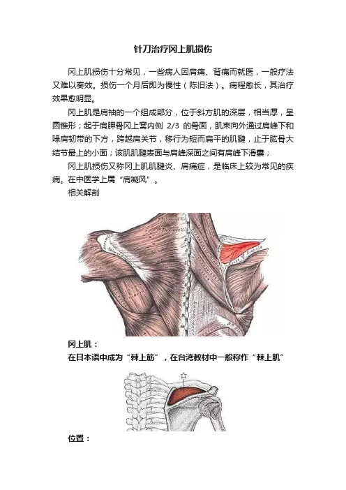 针刀治疗冈上肌损伤