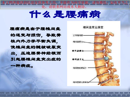 腰痛病健康教育培训课件