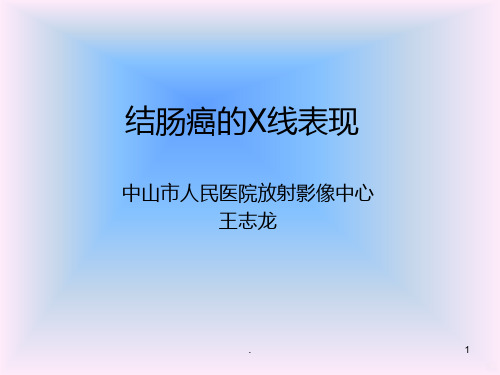 结肠癌的X线表现PPT课件