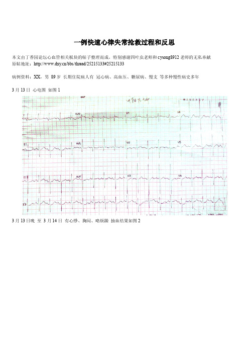 一例快速心律失常的抢救过程和反思