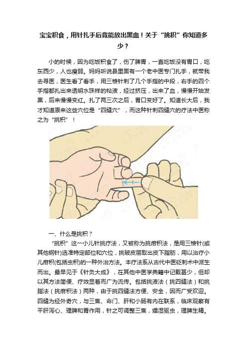 宝宝积食，用针扎手后竟能放出黑血！关于“挑积”你知道多少？