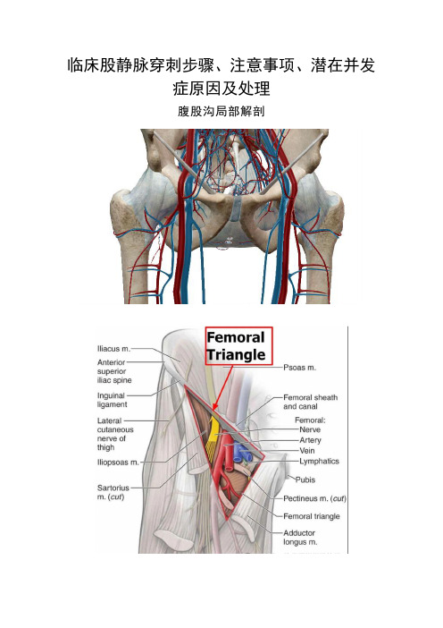 临床股静脉穿刺步骤、注意事项、潜在并发症原因及处理