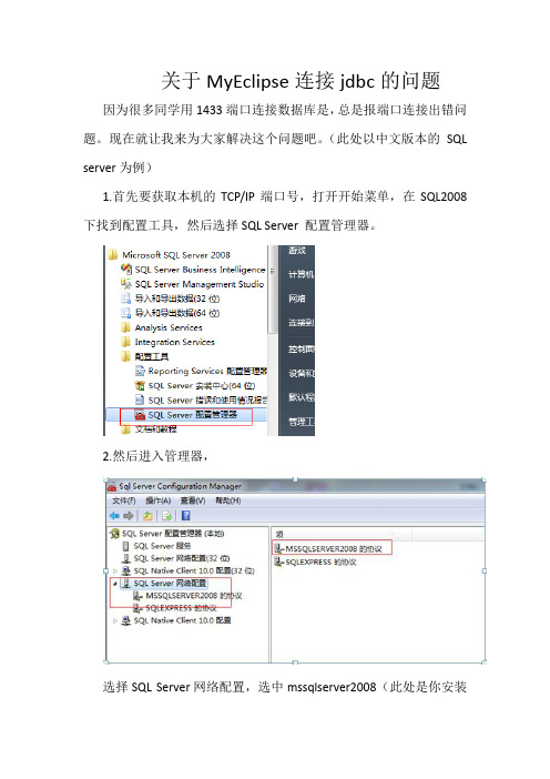 关于MyEclipse连接jdbc的问题