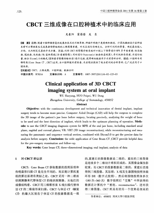 CBCT三维成像在口腔种植术中的临床应用