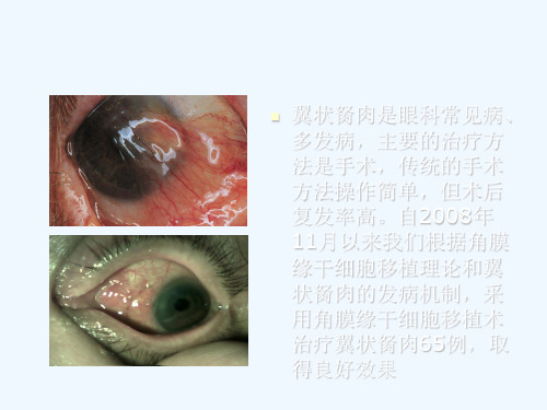 自体角膜缘干细胞