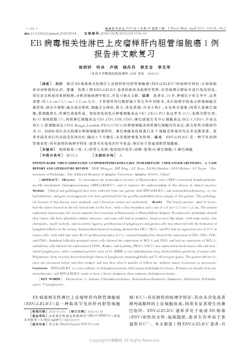 EB病毒相关性淋巴上皮瘤样肝内胆管细胞癌1例报告并文献复习