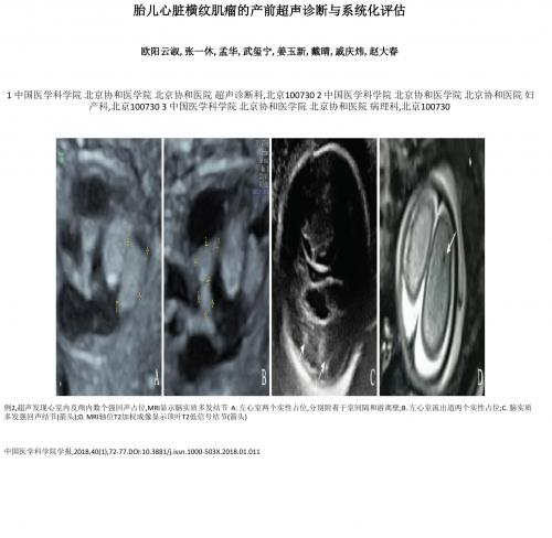 胎儿心脏横纹肌瘤的产前超声诊断与系统化