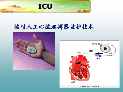 推荐-精品课件临时人工心脏起搏器监护技术 精品