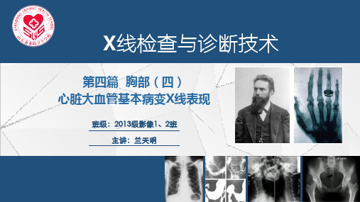 X线检查与诊断技术课件-第四篇胸部四