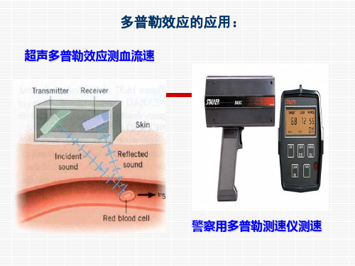 多普勒效应及其医学应用PPT课件