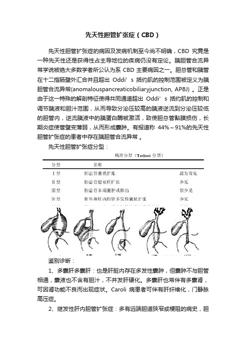 先天性胆管扩张症（CBD）