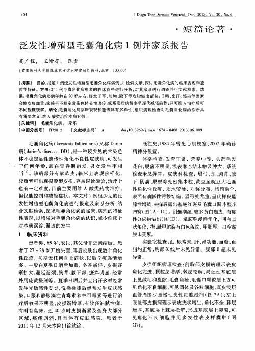 泛发性增殖型毛囊角化病1例并家系报告