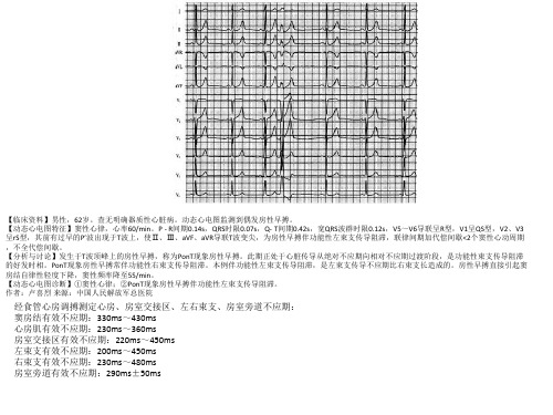 卢喜烈心电图