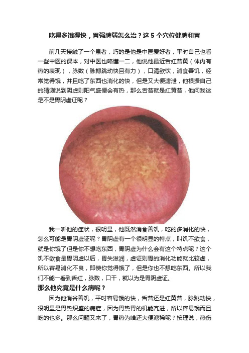 吃得多饿得快，胃强脾弱怎么治？这5个穴位健脾和胃