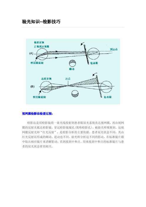 检影