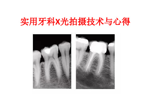 小牙片的拍摄技巧