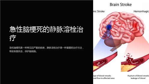 急性脑梗死的静脉溶栓治疗