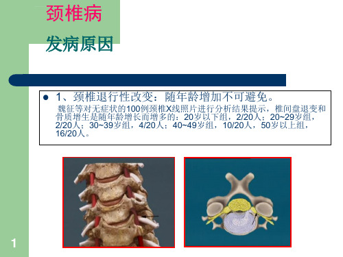 颈腰椎病的预防与自我保健ppt课件.ppt