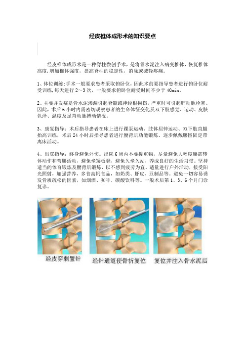 经皮椎体成形术的知识要点