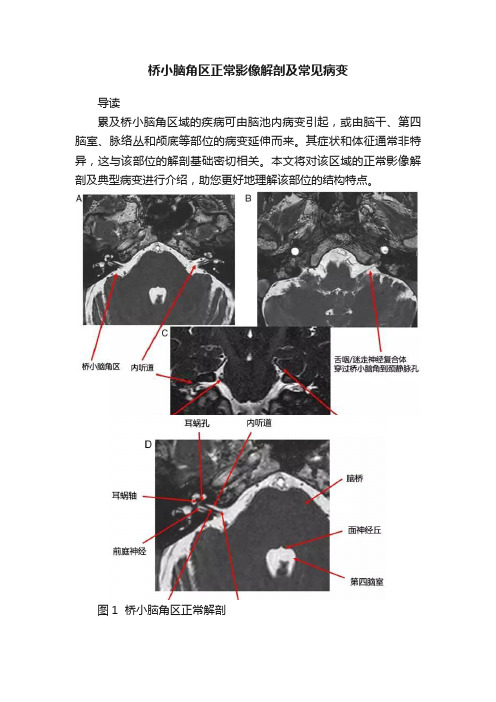 桥小脑角区正常影像解剖及常见病变