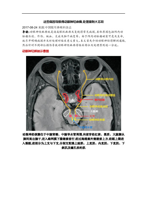 这些病因导致的动眼神经麻痹,处理原则大不同