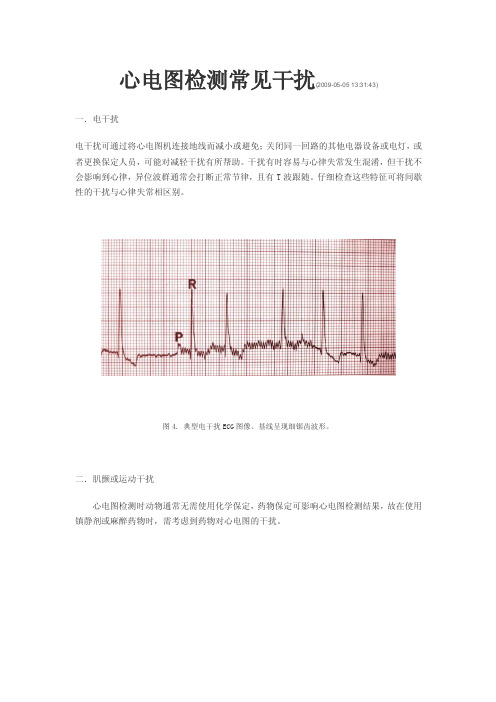 心电图检测常见干扰