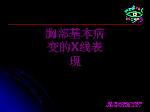 胸部基本病变的X线表现优质PPT课件