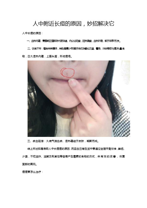 人中附近长痘的原因,妙招解决它