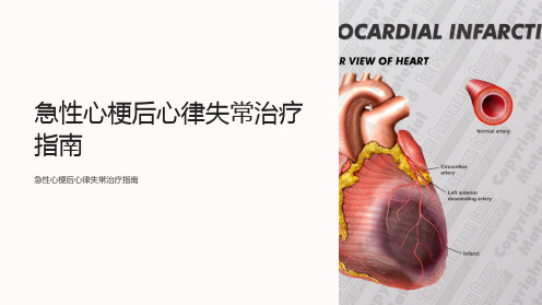 急性心梗后心律失常治疗指南